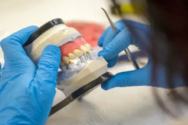 Zirconia Bridge